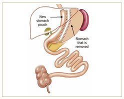 Slider image (4) The Bariatric Group
